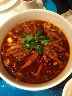 金手指